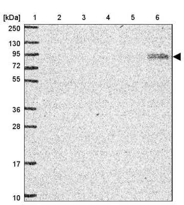 Western Blot: STAT5A Antibody [NBP2-46777]