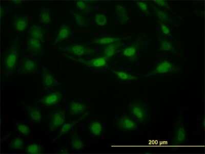 Immunocytochemistry/ Immunofluorescence: STAT5b Antibody (2D1) [H00006777-M03]