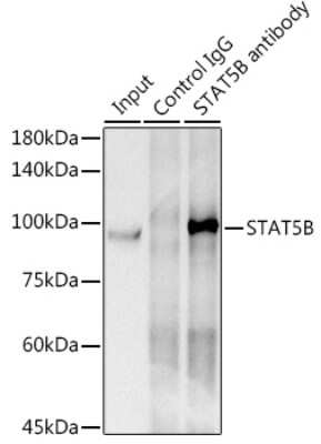 Immunoprecipitation: STAT5b Antibody (6P5T0) [NBP3-15778]