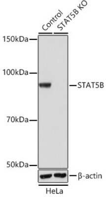Knockout Validated: STAT5b Antibody (6P5T0) [NBP3-15778]