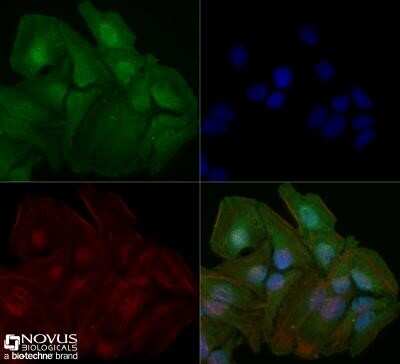 Immunocytochemistry/ Immunofluorescence: STAT6 Antibody (177C322.1) - Azide and BSA Free [NBP2-80965]