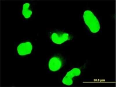 Immunocytochemistry/ Immunofluorescence: STAT6 Antibody (6C10) [H00006778-M01]