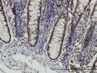 Immunohistochemistry-Paraffin: STAT6 Antibody (6C10) [H00006778-M01]