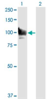 Western Blot: STAT6 Antibody (6C10) [H00006778-M01]