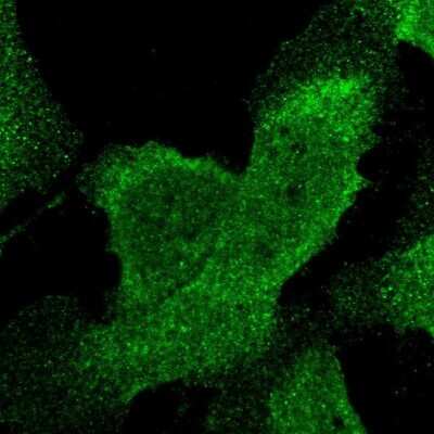 Immunocytochemistry/ Immunofluorescence: STAT6 Antibody [NBP1-85345]