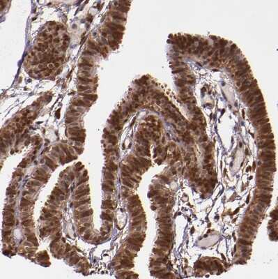 Immunohistochemistry-Paraffin: STAT6 Antibody [NBP1-85345]
