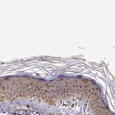 Immunohistochemistry-Paraffin: STAT6 Antibody [NBP1-85345]