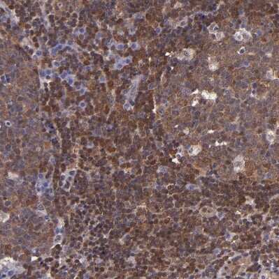 Immunohistochemistry-Paraffin: STAT6 Antibody [NBP1-85345]