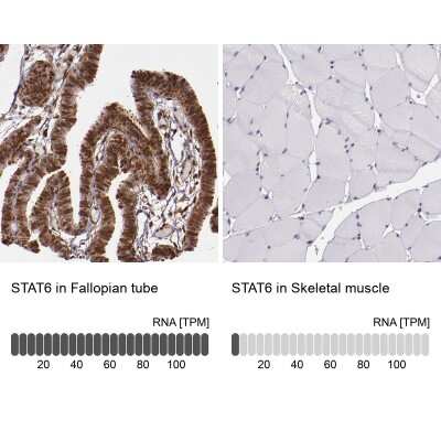 Immunohistochemistry-Paraffin: STAT6 Antibody [NBP1-85345]