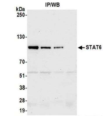 Immunoprecipitation: STAT6 Antibody (BLR147J) [NBP3-14726]