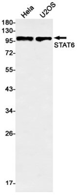 Western Blot: STAT6 Antibody (S04-0B5) [NBP3-20075]