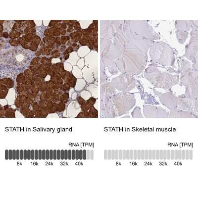 Immunohistochemistry-Paraffin: STATH Antibody [NBP1-92450]