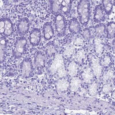 Immunohistochemistry-Paraffin: STATH Antibody [NBP1-92450]