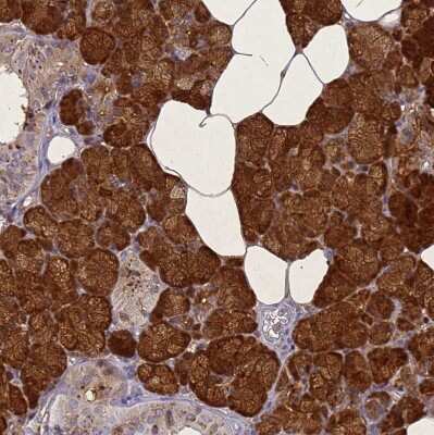 Immunohistochemistry-Paraffin: STATH Antibody [NBP1-92450]