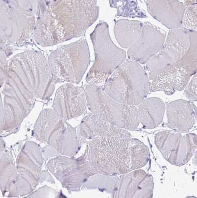 Immunohistochemistry-Paraffin: STATH Antibody [NBP1-92450]