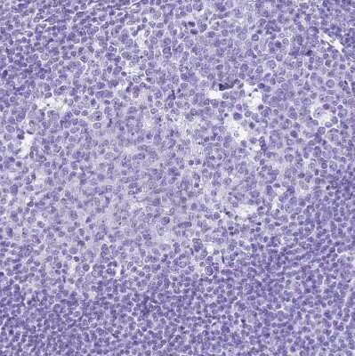Immunohistochemistry-Paraffin: STATH Antibody [NBP1-92450]