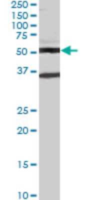 Western Blot: STAU2 Antibody (1B9) [H00027067-M04]