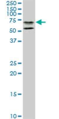Western Blot: STAU2 Antibody (3E9) [H00027067-M09]