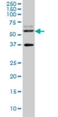 Western Blot: STAU2 Antibody (3E9) [H00027067-M09]