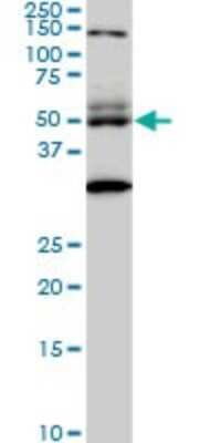 Western Blot: STAU2 Antibody (5C5) [H00027067-M01]