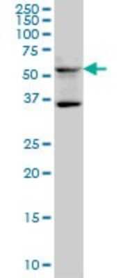 Western Blot: STAU2 Antibody (5C5) [H00027067-M01]