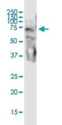 Western Blot: STAU2 Antibody (5C5) [H00027067-M01]