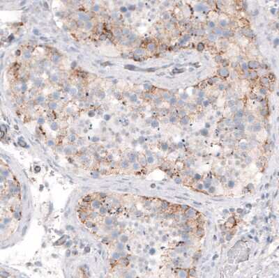 Immunohistochemistry-Paraffin: STAU2 Antibody [NBP1-89380]