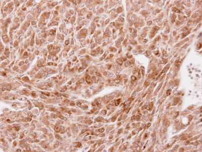 Immunohistochemistry-Paraffin: STAU2 Antibody [NBP2-20507]
