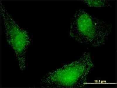 Immunocytochemistry/ Immunofluorescence: STCH Antibody (1H8) [H00006782-M02]