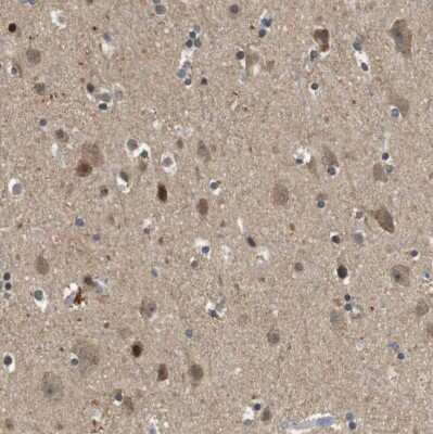 Immunohistochemistry-Paraffin: STCH Antibody [NBP1-80715]