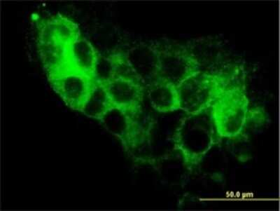 Immunocytochemistry/ Immunofluorescence: STEAP1 Antibody (4F6-1F3) [H00026872-M01]