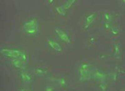Immunocytochemistry/ Immunofluorescence: STEAP1 Antibody (J2D2) - BSA Free [NBP1-07094]