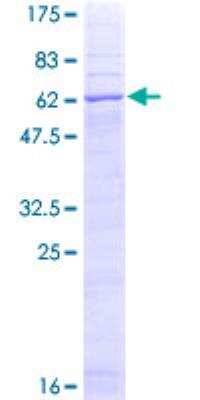 SDS-PAGE: Recombinant Human STEAP1 GST (N-Term) Protein [H00026872-P01]