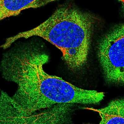 Immunocytochemistry/ Immunofluorescence: STEAP3/TSAP6 Antibody [NBP2-13395]