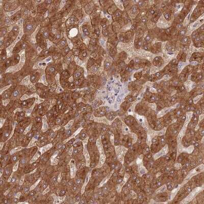 Immunohistochemistry-Paraffin: STEAP3/TSAP6 Antibody [NBP2-13395]