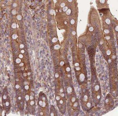 Immunohistochemistry-Paraffin: STEAP3/TSAP6 Antibody [NBP2-13395]