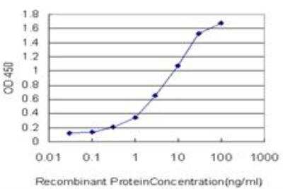 ELISA: STI1 Antibody (1E3) [H00010963-M11]