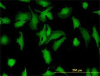 Immunocytochemistry/ Immunofluorescence: STI1 Antibody (1E3) [H00010963-M11]