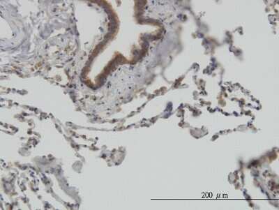 Immunohistochemistry-Paraffin: STI1 Antibody (1E3) [H00010963-M11]