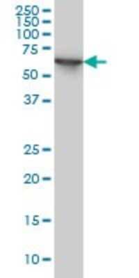 Western Blot: STI1 Antibody (1E3) [H00010963-M11]