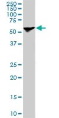 Western Blot: STI1 Antibody (1E3) [H00010963-M11]
