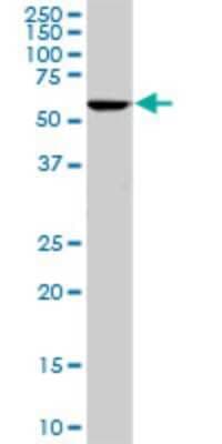 Western Blot: STI1 Antibody (1E3) [H00010963-M11]