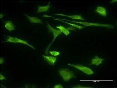 Immunocytochemistry/ Immunofluorescence: STI1 Antibody (2E11) [H00010963-M35]
