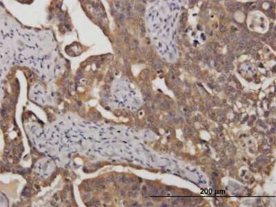 Immunohistochemistry-Paraffin: STI1 Antibody (2E11) [H00010963-M35]