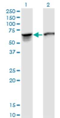 Western Blot: STI1 Antibody (2E11) [H00010963-M35]