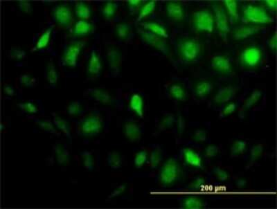 Immunocytochemistry/ Immunofluorescence: STI1 Antibody (4B6) [H00010963-M01]