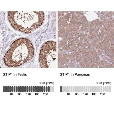 Immunohistochemistry-Paraffin: STI1 Antibody [NBP2-32621]