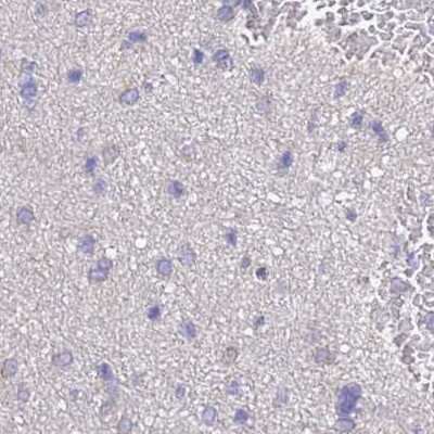 Immunohistochemistry-Paraffin: STI1 Antibody [NBP2-33411]