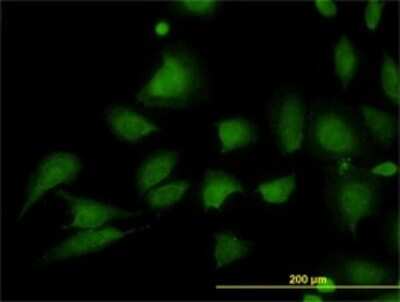Immunocytochemistry/ Immunofluorescence: STIM1 Antibody (5A2) [H00006786-M01]