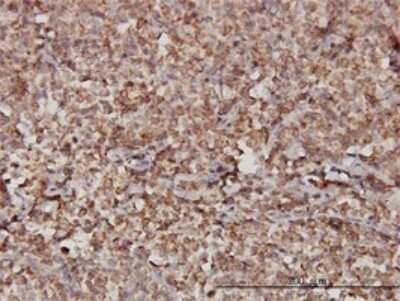 Immunohistochemistry-Paraffin: STIM1 Antibody (5A2) [H00006786-M01]